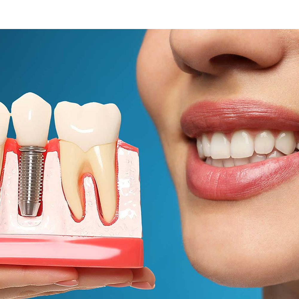 تركيبات الاسنان 